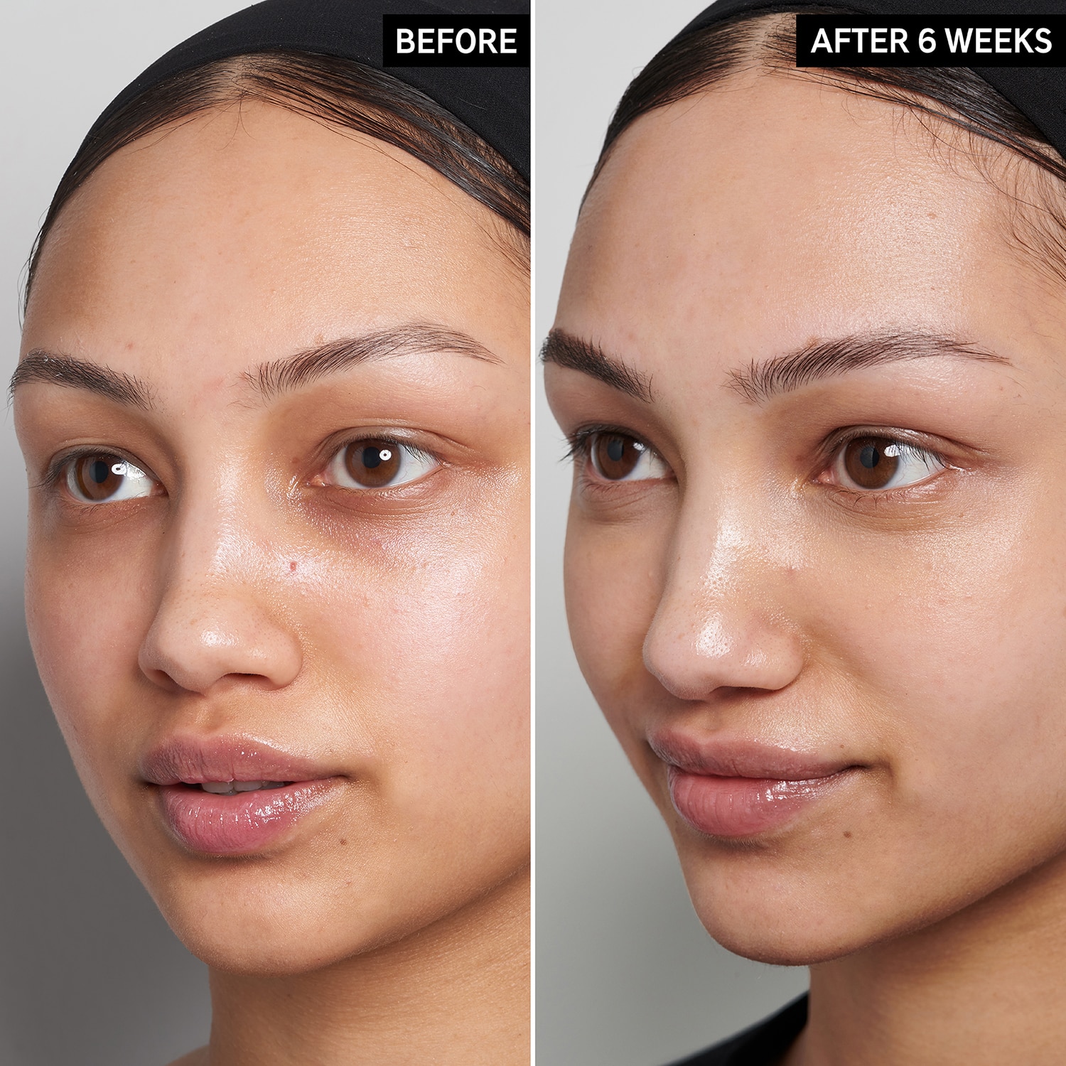 15% VITAMIN C AND EGF (SUERO FACIAL)